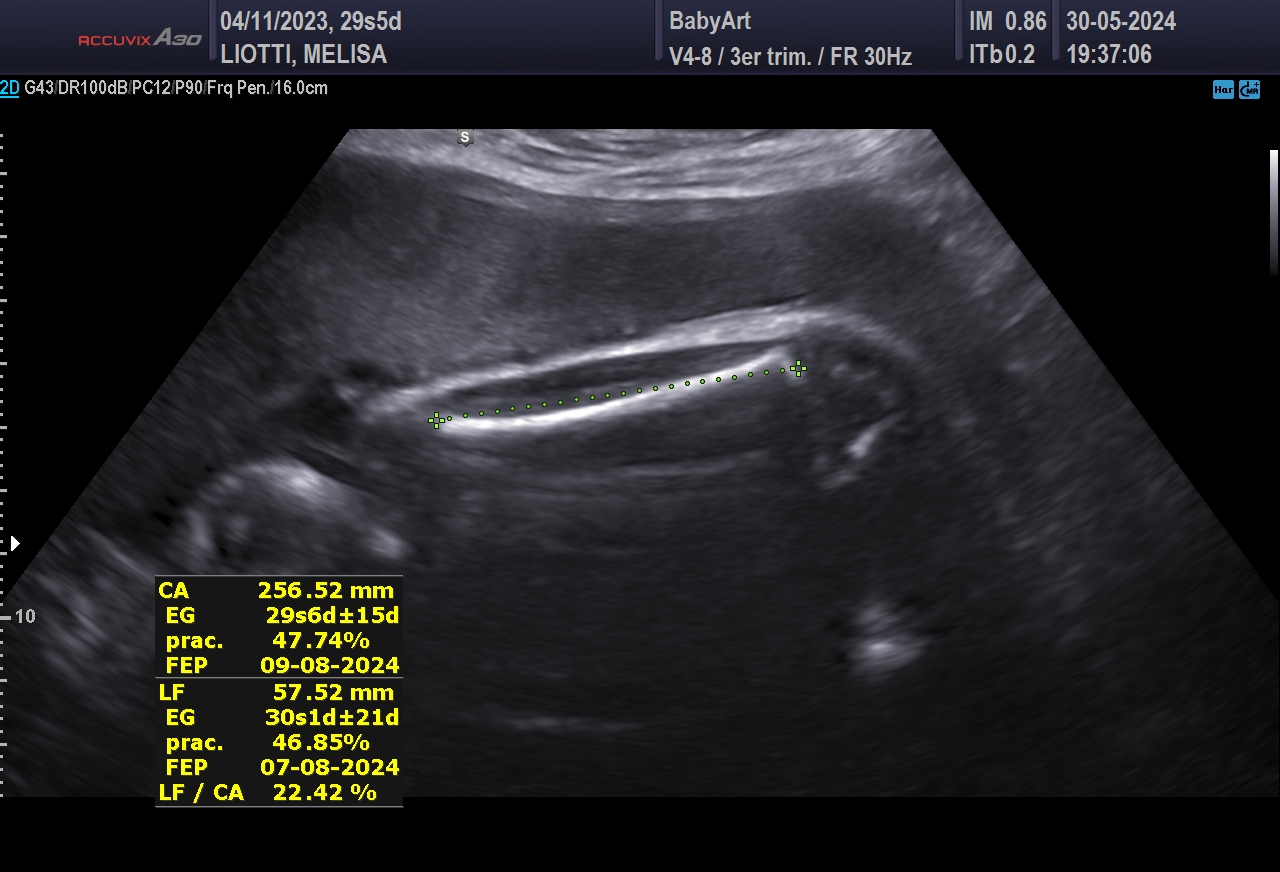 JULIA DE MELISA LIOTTI_0008.JPG